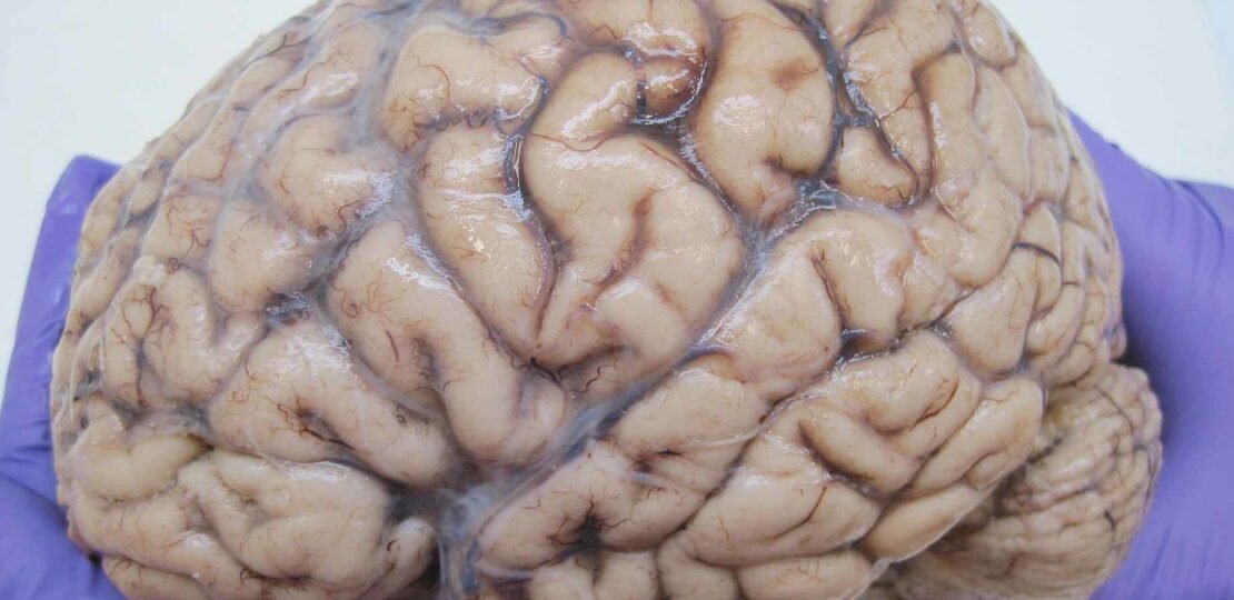 human-brain